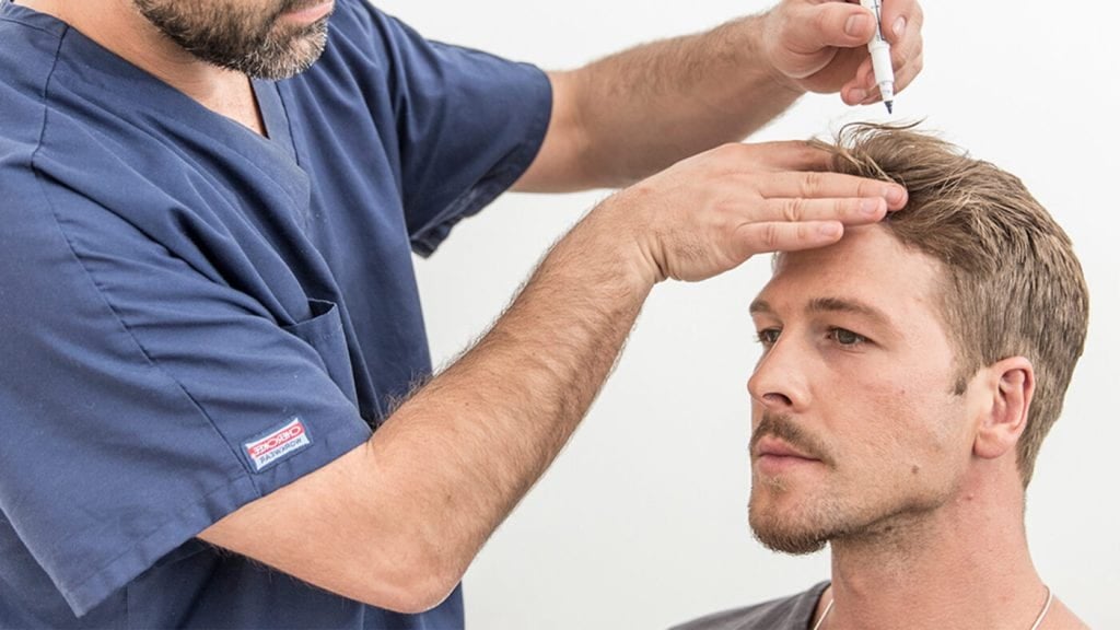 How Long Does Hair Transplant Recovery Take?